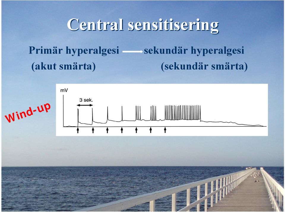 smärta) sekundär