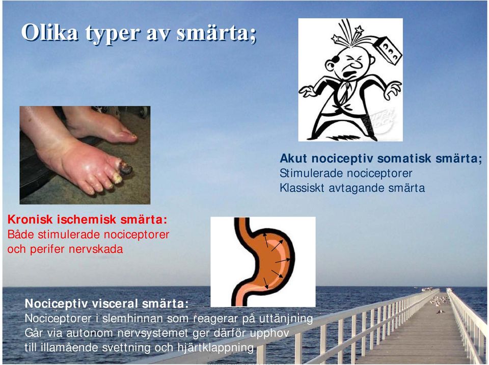 perifer nervskada Nociceptiv visceral smärta: Nociceptorer i slemhinnan som reagerar på