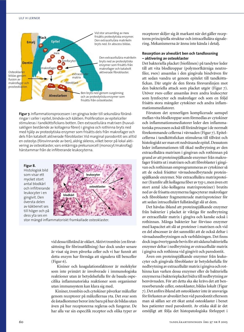 Dentin Osteoklaster bildas genom fusion av makrofager och prosteoklaster.