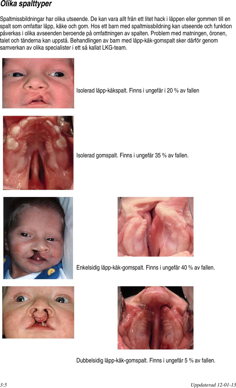 Problem med matningen, öronen, talet och tänderna kan uppstå. Behandlingen av barn med läpp-käk-gomspalt sker därför genom samverkan av olika specialister i ett så kallat LKG-team.