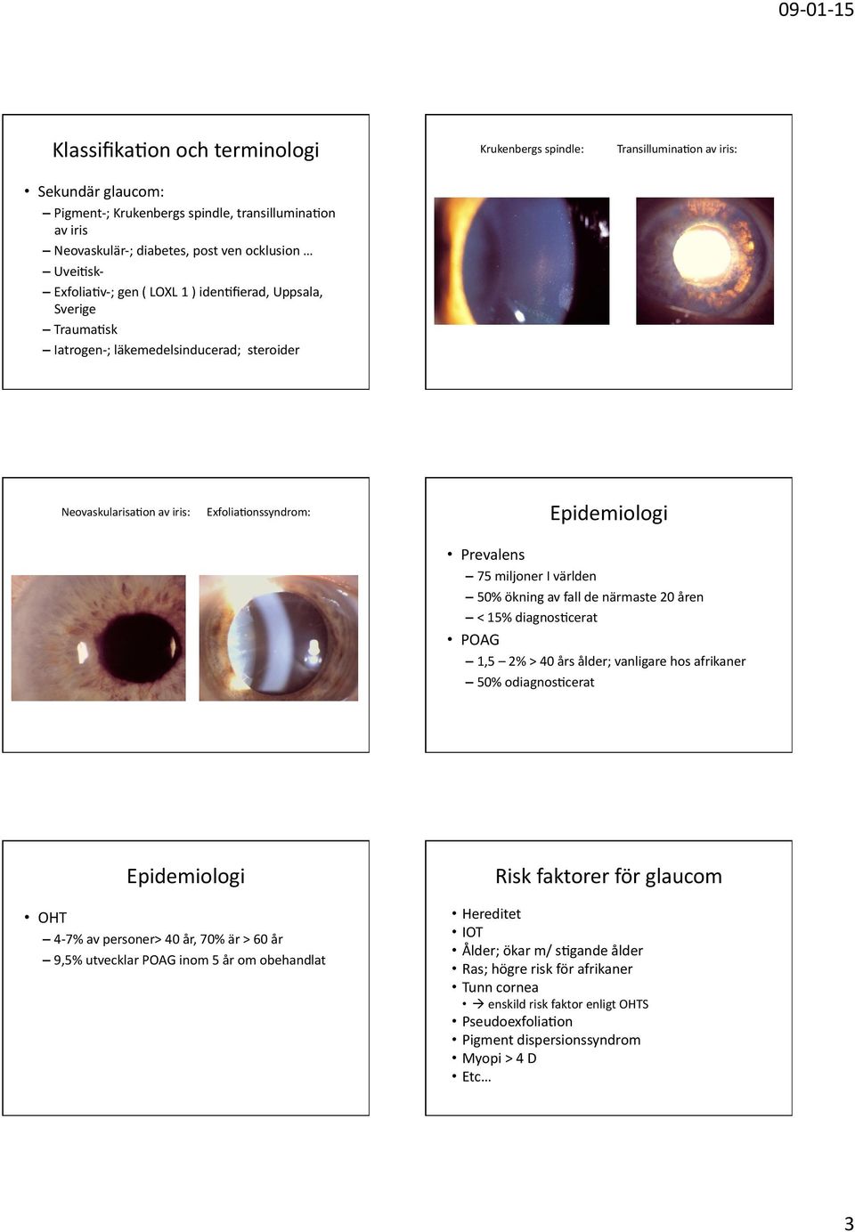 75miljonerIvärlden 50%ökningavfalldenärmaste20åren <15%diagnos6cerat POAG 1,5 2%>40årsålder;vanligarehosafrikaner 50%odiagnos6cerat Epidemiologi OHT 4 7%avpersoner>40år,70%är>60år