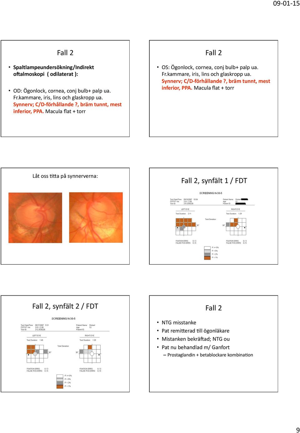 maculaflat+torr Fall2 OS:Ögonlock,cornea,conjbulb+palpua. Fr.