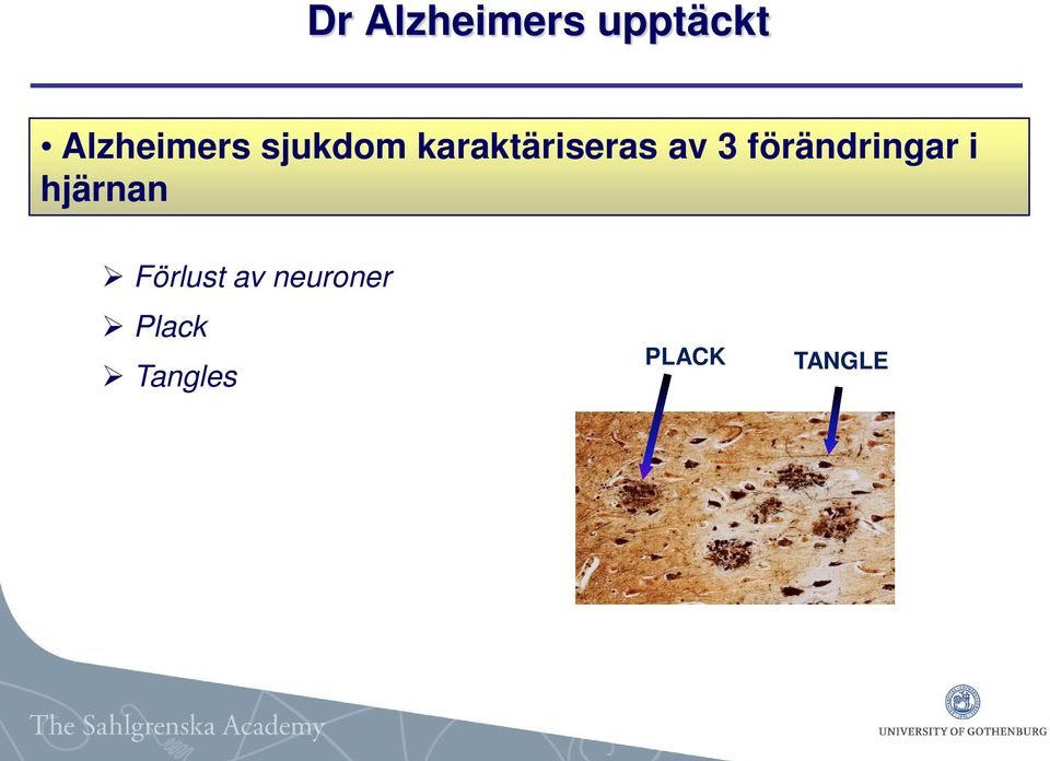 karaktäriseras av 3 förändringar