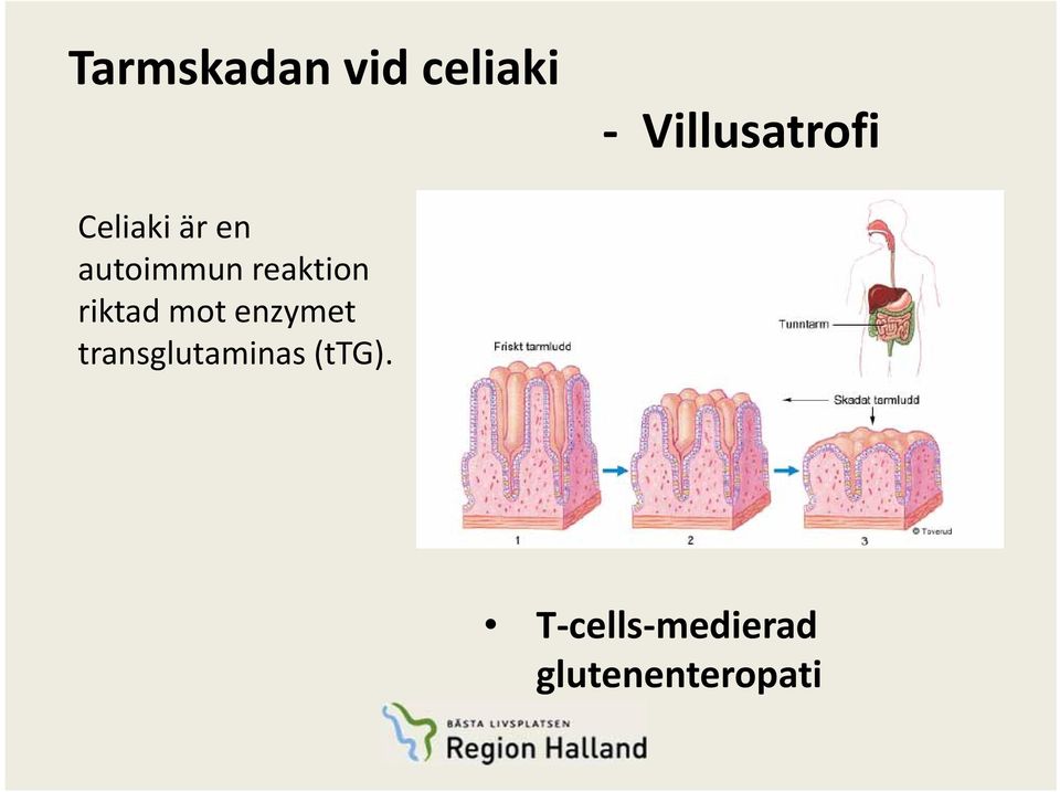 riktad mot enzymet transglutaminas