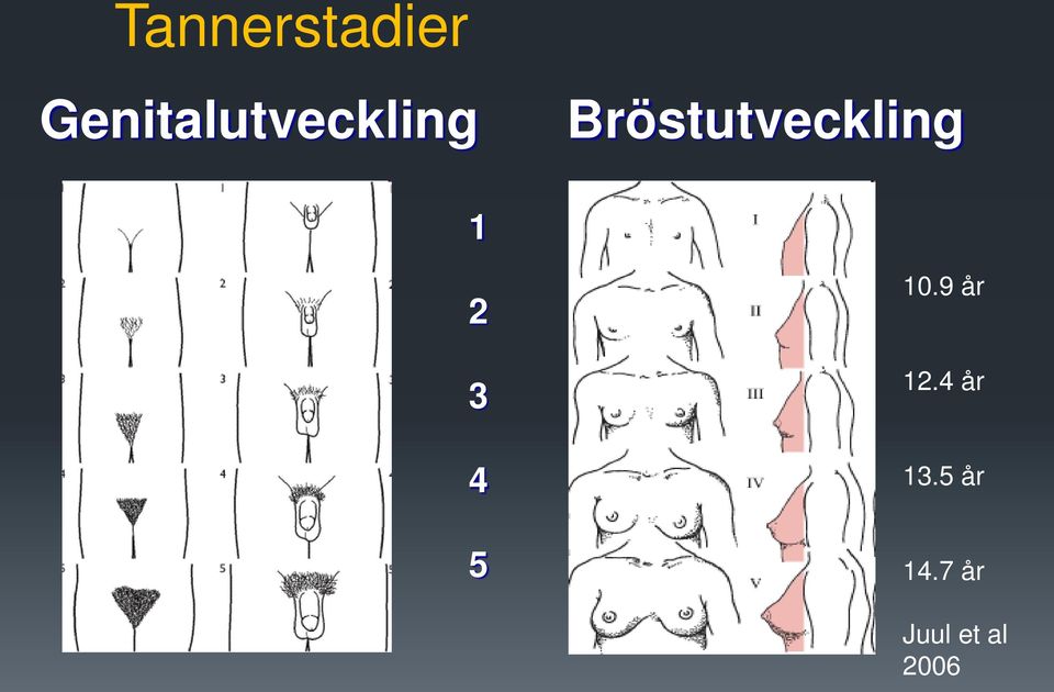 Bröstutveckling 1 2 3 4 5