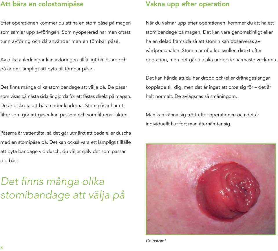 Det finns många olika stomibandage att välja på. De påsar som visas på nästa sida är gjorda för att fästas direkt på magen. De är diskreta att bära under kläderna.