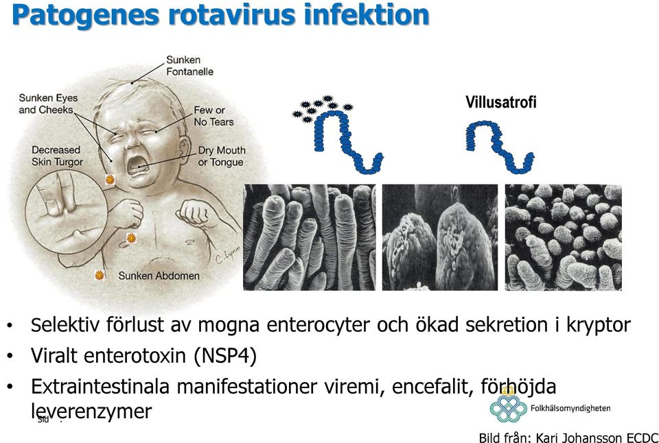 enterotoxin (NSP4) Extraintestinala manifestationer viremi,