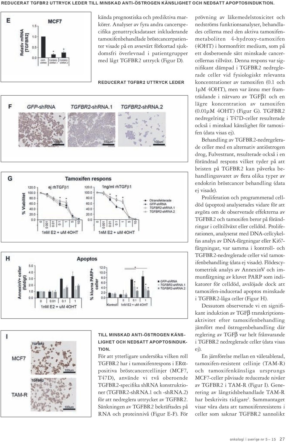 uttryck (Figur D). REDUCERAT TGFBR2 UTTRYCK LEDER TILL MINSKAD ANTI-ÖSTROGEN KÄNS- LIGHET OCH NEDSATT APOPTOSINDUK- TION.