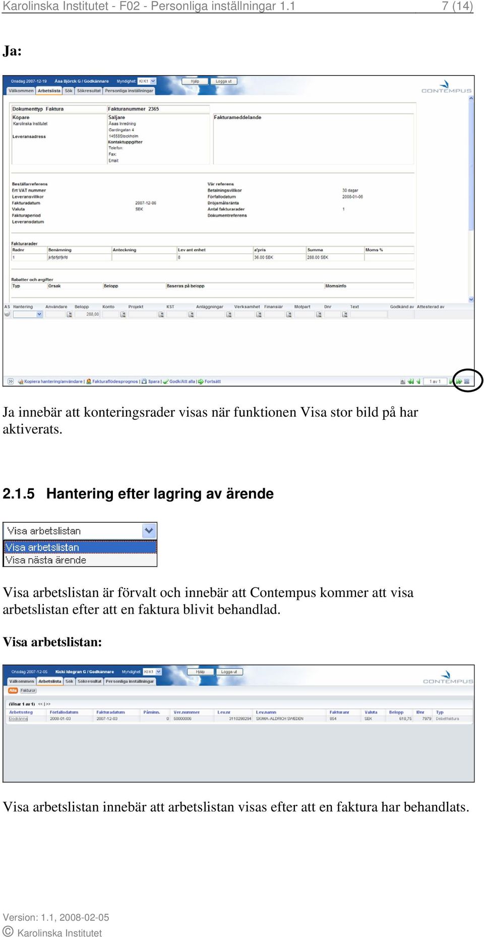 Hantering efter lagring av ärende Visa arbetslistan är förvalt och innebär att Contempus kommer att visa