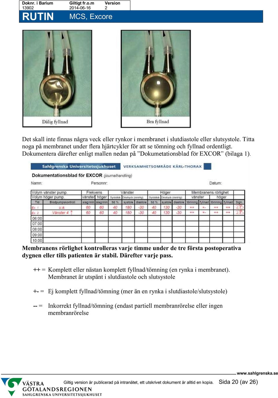 Membranens rörlighet kontrolleras varje timme under de tre första postoperativa dygnen eller tills patienten är stabil. Därefter varje pass.