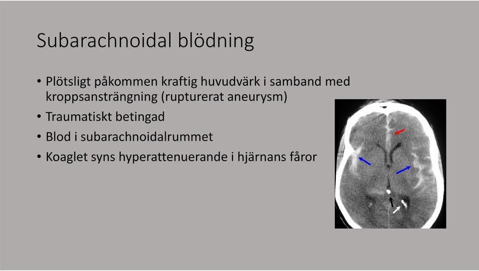 (rupturerat aneurysm) Traumatiskt betingad Blod i