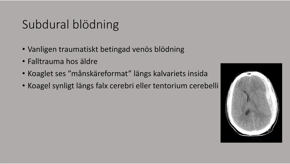 månskäreformat längs kalvariets insida Koagel