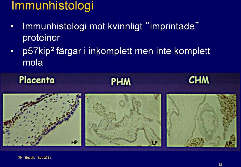 proteiner p57kip 2 färgar i