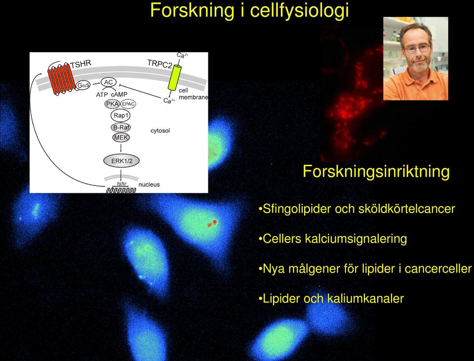 sköldkörtelcancer Cellers