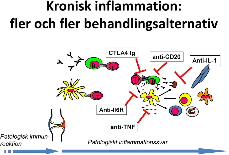 anti-cd20 Anti-IL-1 T B T Anti-Il6R