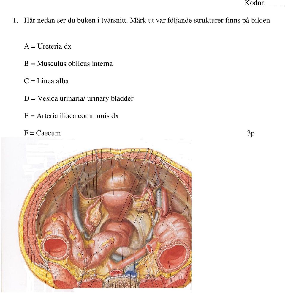 Ureteria dx B = Musculus oblicus interna C = Linea alba D
