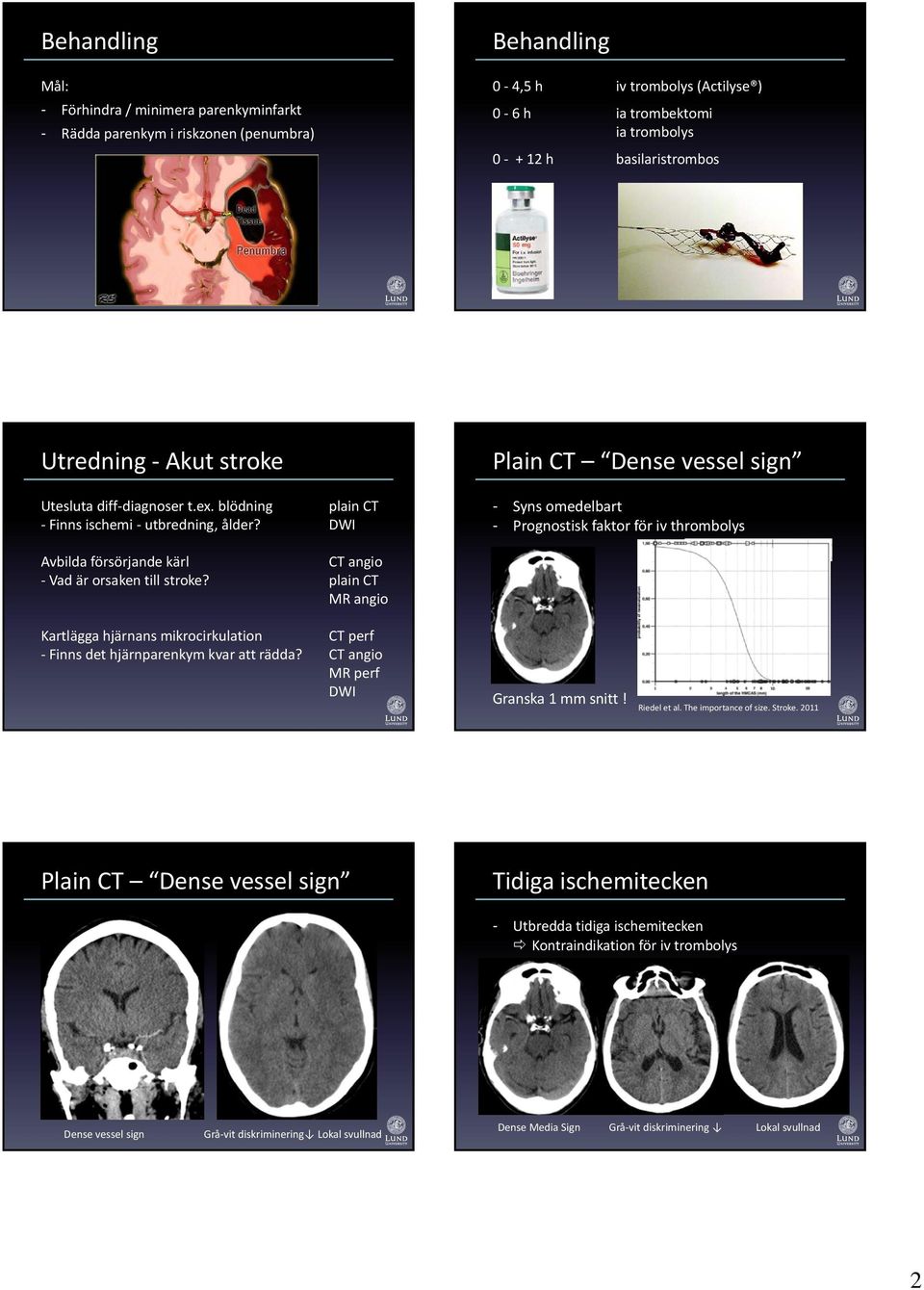 DWI Plain CT Dense vessel sign - Syns omedelbart - Prognostisk faktor för iv thrombolys Avbilda försörjande kärl CT angio Vad är orsaken till stroke?