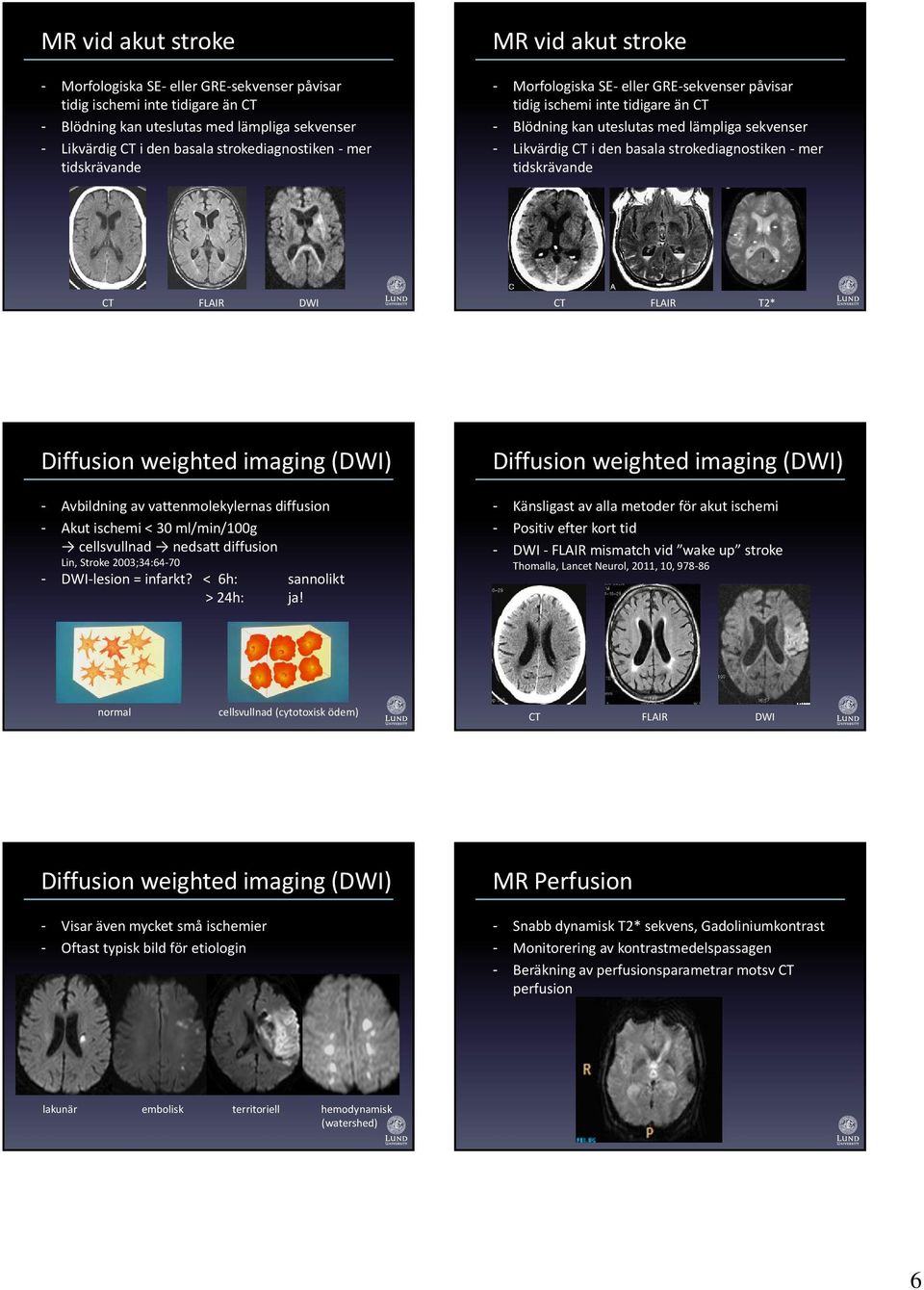 Stroke 2003;34:64 70 - DWI lesion = infarkt? < 6h: sannolikt > 24h: ja!