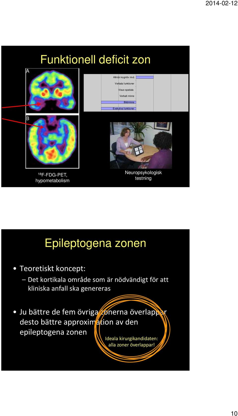 koncept: Det kortikala område som är nödvändigt för att kliniska anfall ska genereras Ju bättre de fem övriga