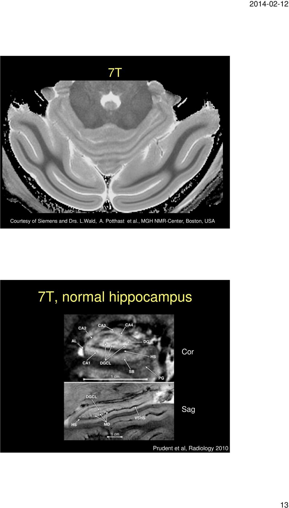 , MGH NMR-Center, Boston, USA 7T,