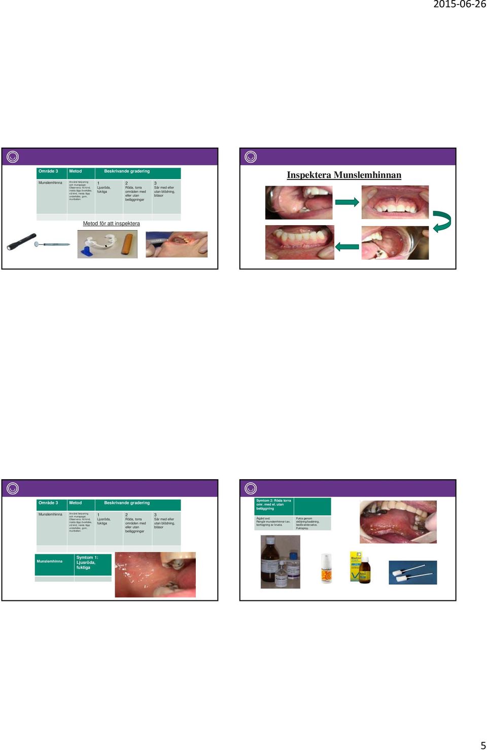 beläggningar Sår med eller utan blödning, blåsor Inspektera Munslemhinnan Metod för att inspektera Område Metod Beskrivande gradering Symtom : Röda torra omr. med el. utan beläggning Munslemhinna Använd belysning och munspegel.