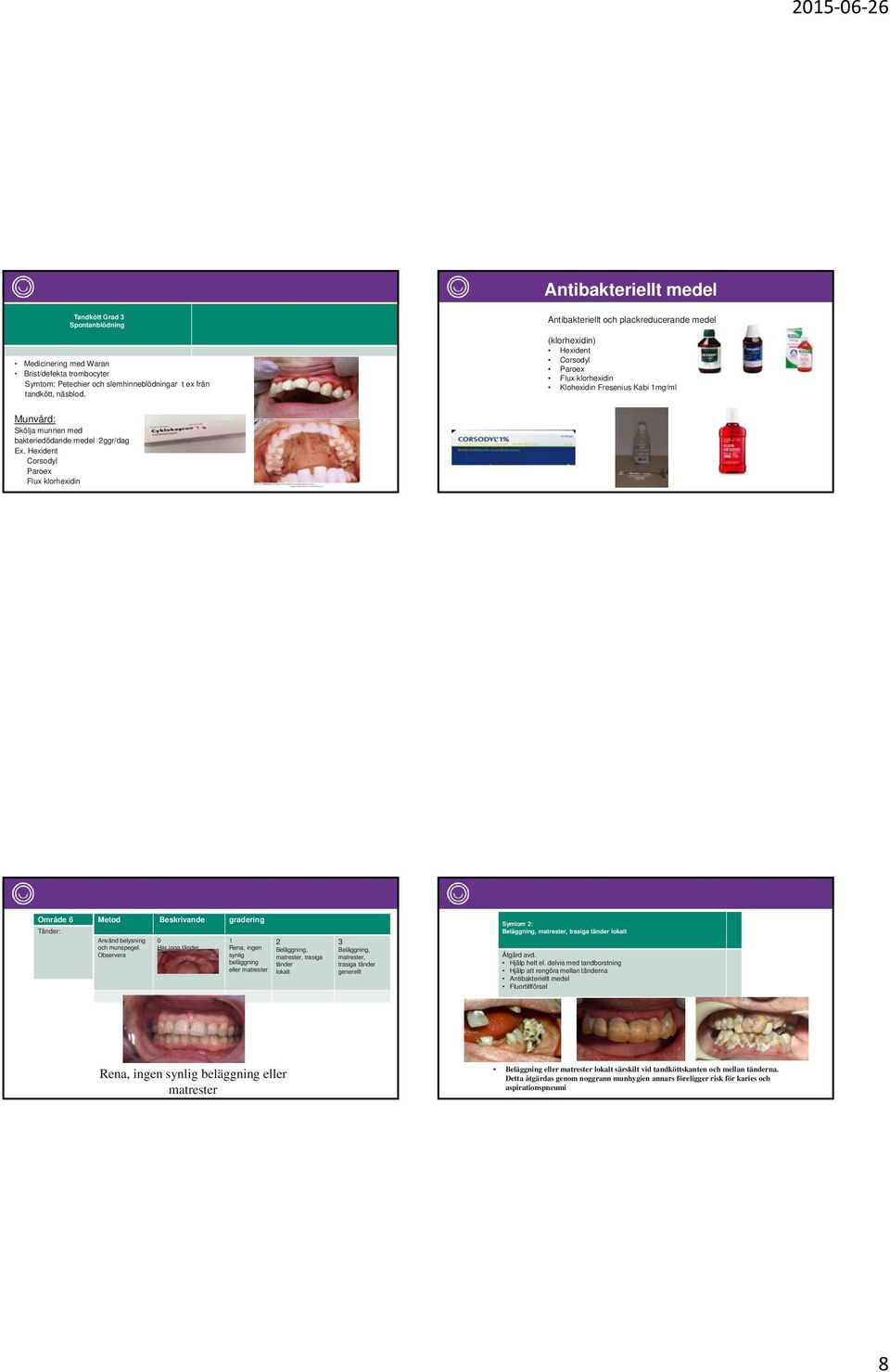 Hexident Corsodyl Paroex Flux klorhexidin Område 6 Tänder: Metod Beskrivande gradering Använd belysning 0 och munspegel.
