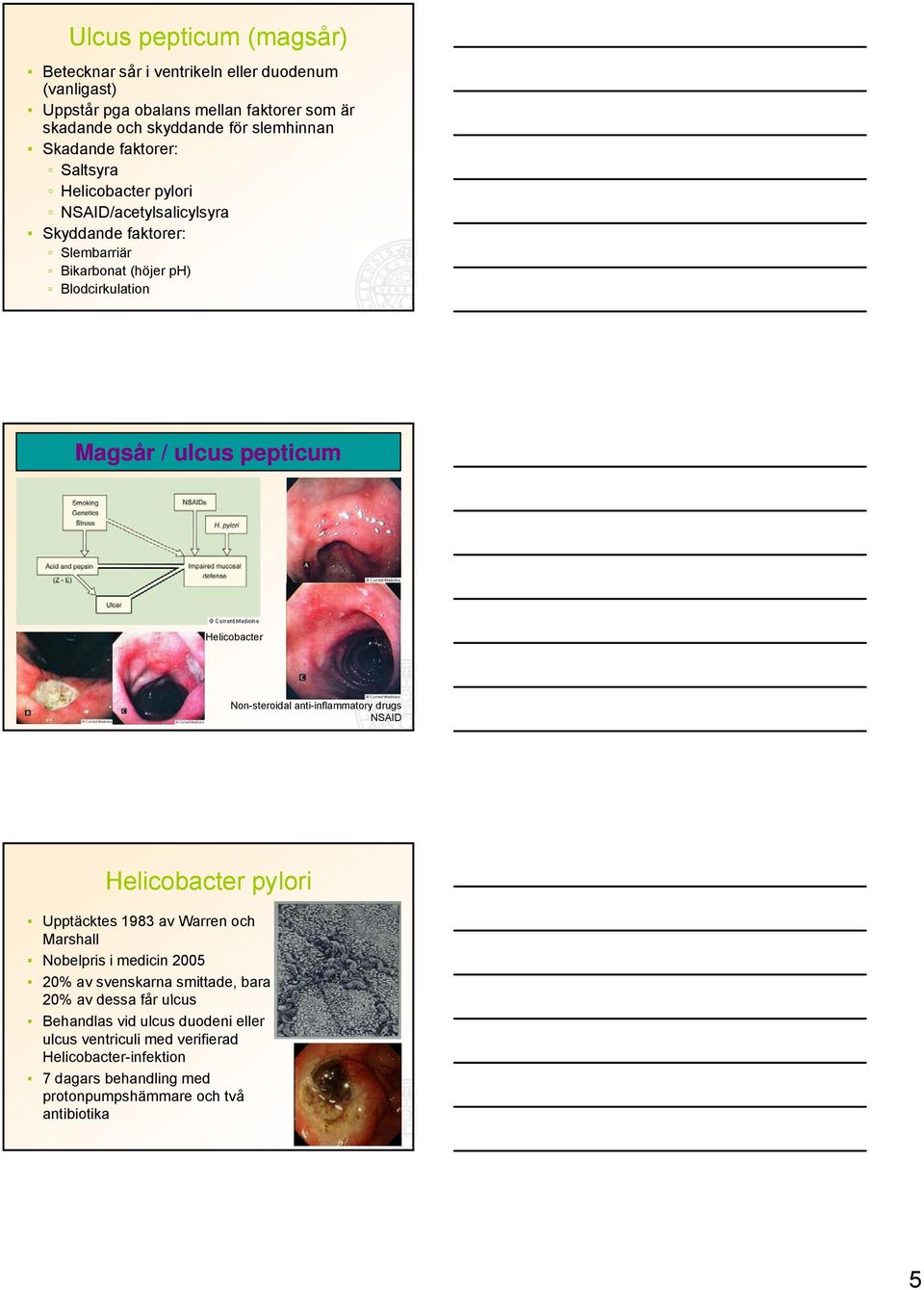 Helicobacter Non-steroidal anti-inflammatory drugs NSAID Helicobacter pylori Upptäcktes 1983 av Warren och Marshall Nobelpris i medicin 2005 20% av svenskarna smittade,