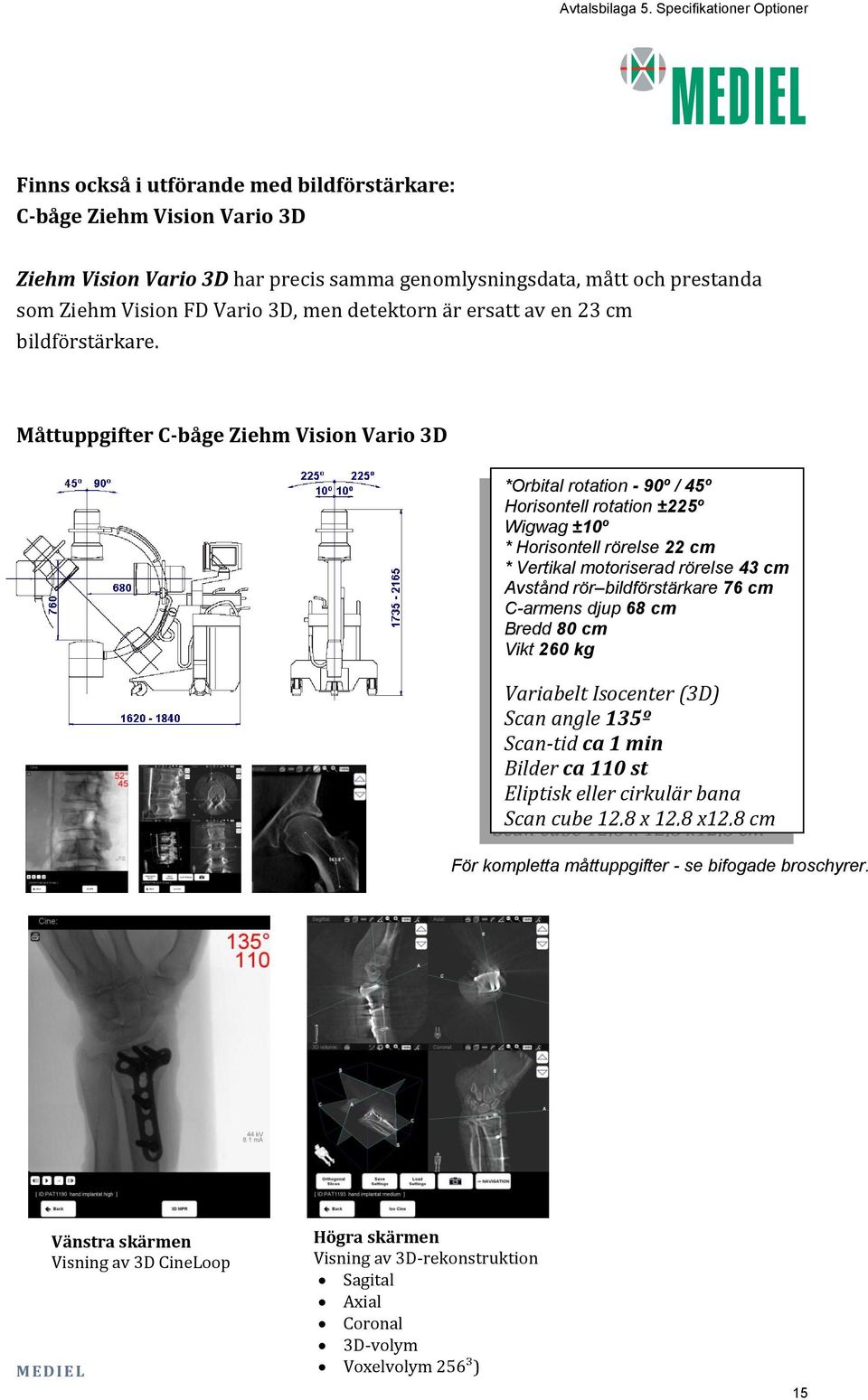 Måttuppgifter C-båge Ziehm Vision Vario 3D *Orbital rotation - 90º / 45º Horisontell rotation ±225º Wigwag ±10º * Horisontell rörelse 22 cm * Vertikal motoriserad rörelse 43 cm Avstånd rör