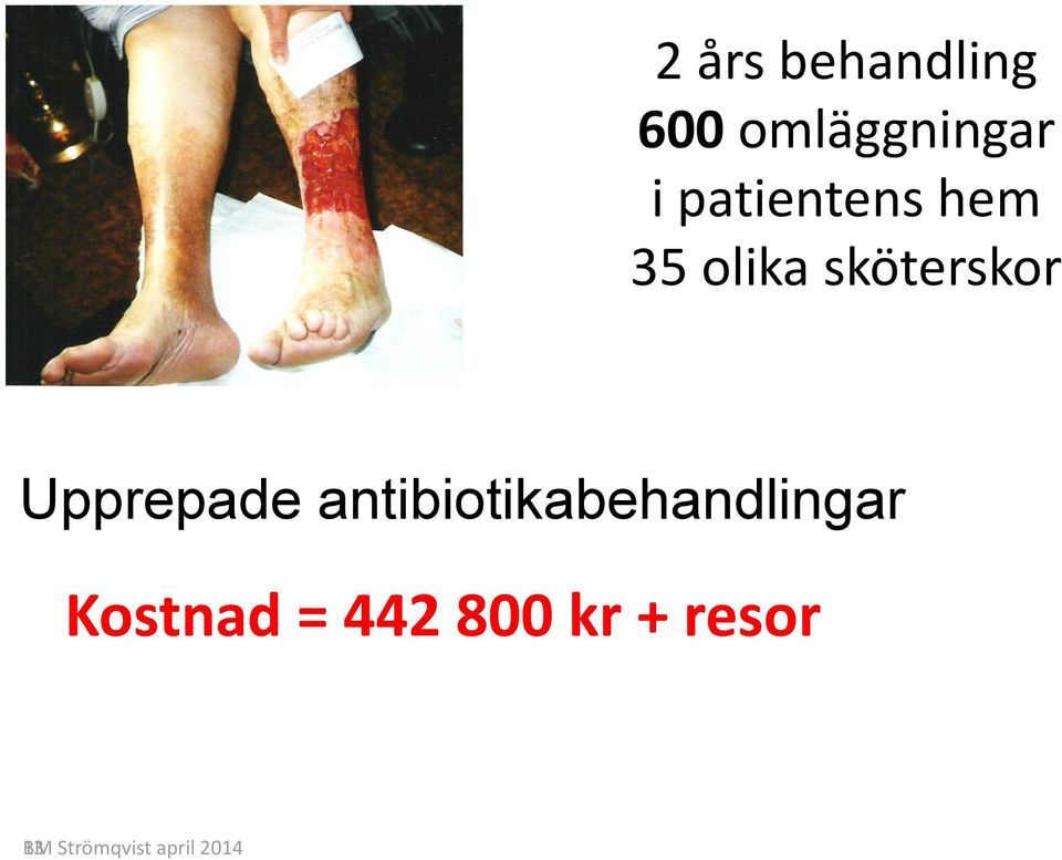 Upprepade antibiotikabehandlingar