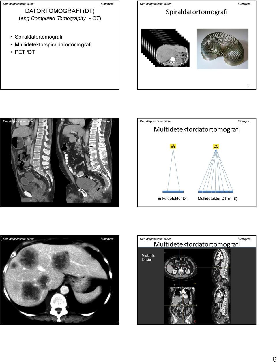Multidetektorspiraldatortomografi PET /DT 32