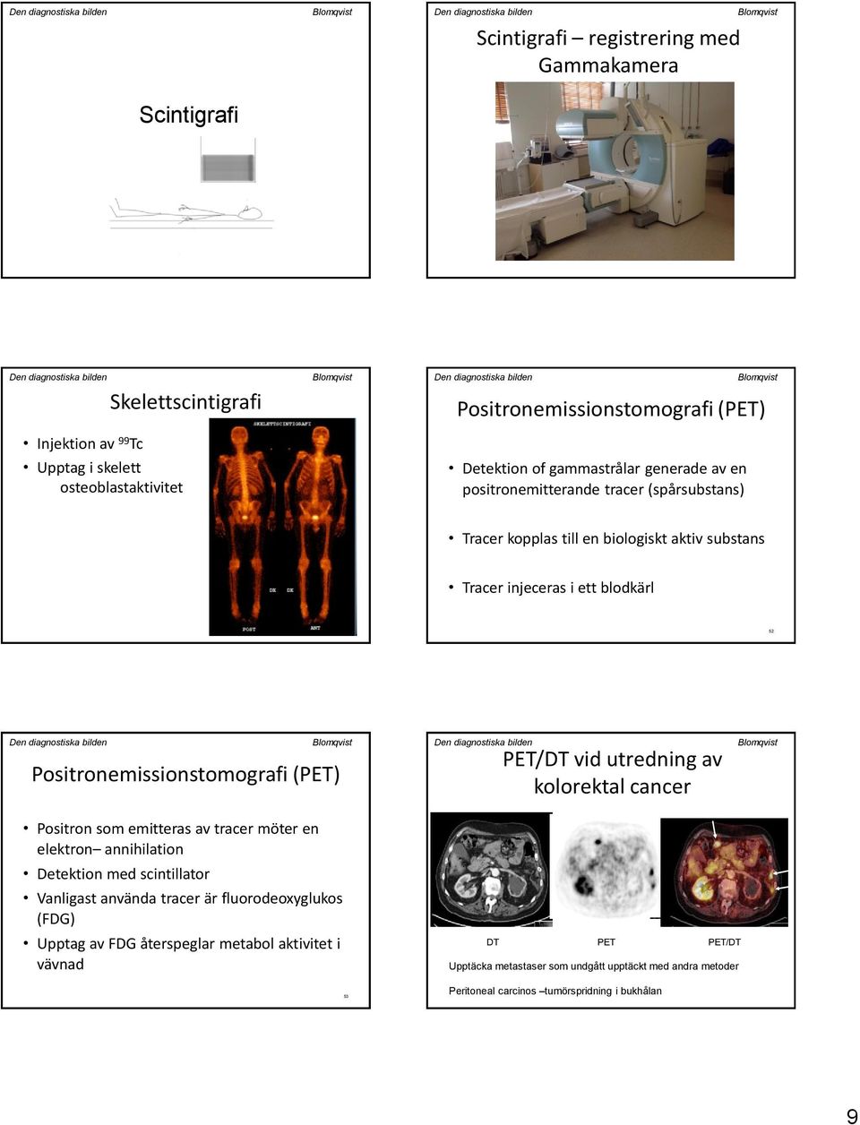 Positronemissionstomografi (PET) PET/DT vid utredning av kolorektal cancer Positron som emitteras av tracer möter en elektron annihilation Detektion med scintillator Vanligast