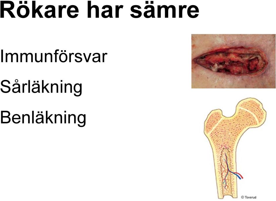 Immunförsvar