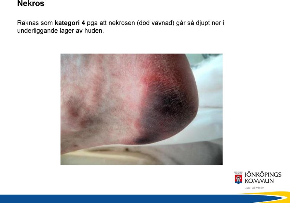 vävnad) går så djupt ner i