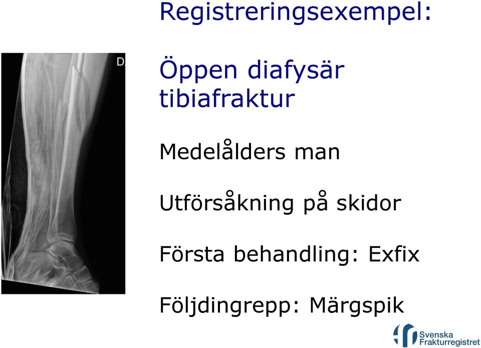 man Utförsåkning på skidor Första