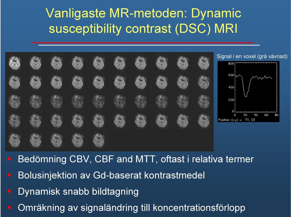 relativa termer Bolusinjektion av Gd-baserat kontrastmedel Dynamisk