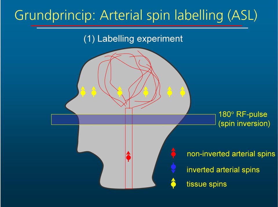 RF-pulse (spin inversion) non-inverted