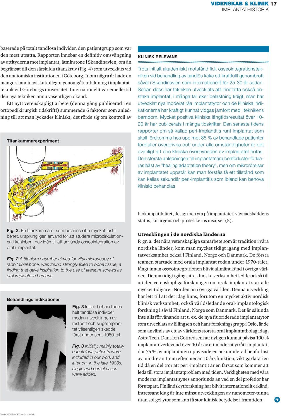 4) som utvecklats vid den anatomiska institutionen i Göteborg. Inom några år hade en mängd skandinaviska kollegor genomgått utbildning i implantatteknik vid Göteborgs universitet.