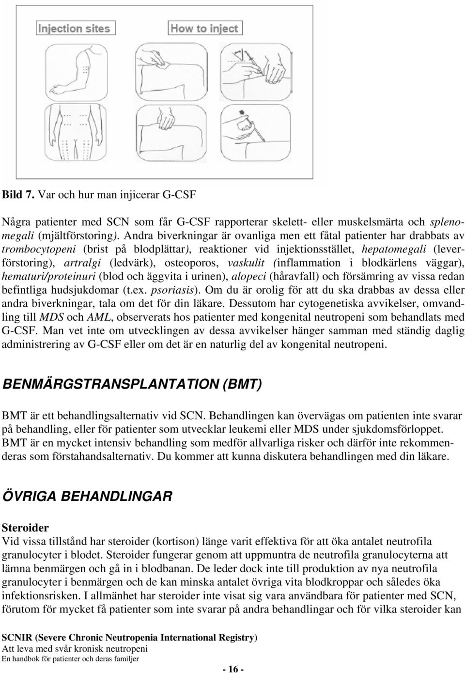 osteoporos, vaskulit (inflammation i blodkärlens väggar), hematuri/proteinuri (blod och äggvita i urinen), alopeci (håravfall) och försämring av vissa redan befintliga hudsjukdomar (t.ex. psoriasis).