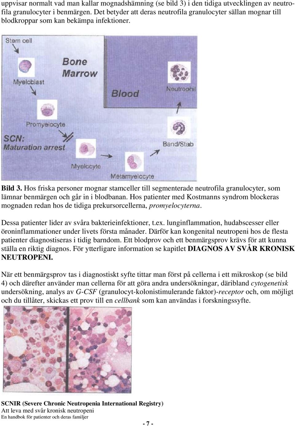 Hos friska personer mognar stamceller till segmenterade neutrofila granulocyter, som lämnar benmärgen och går in i blodbanan.