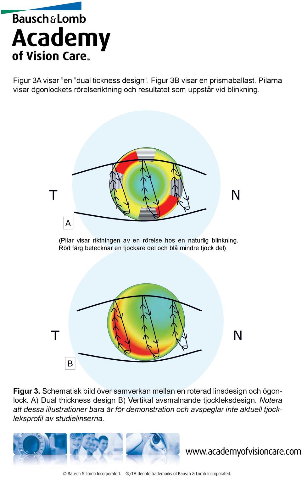T N A (Pilar visar riktningen av en rörelse hos en naturlig blinkning.