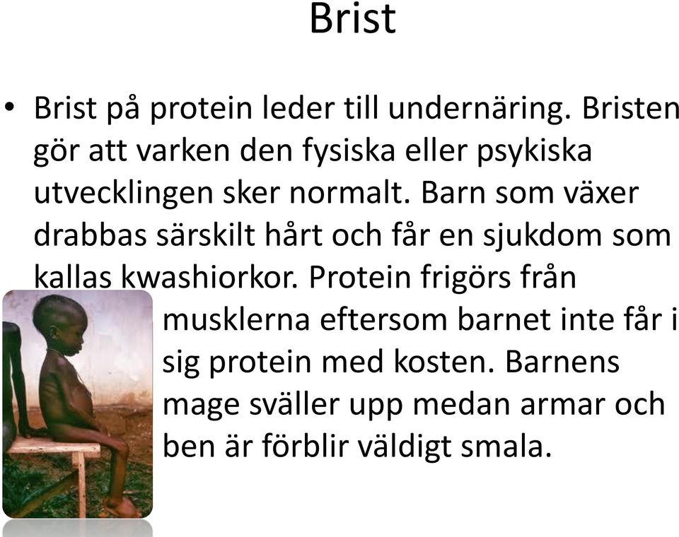 Barn som växer drabbas särskilt hårt och får en sjukdom som kallas kwashiorkor.
