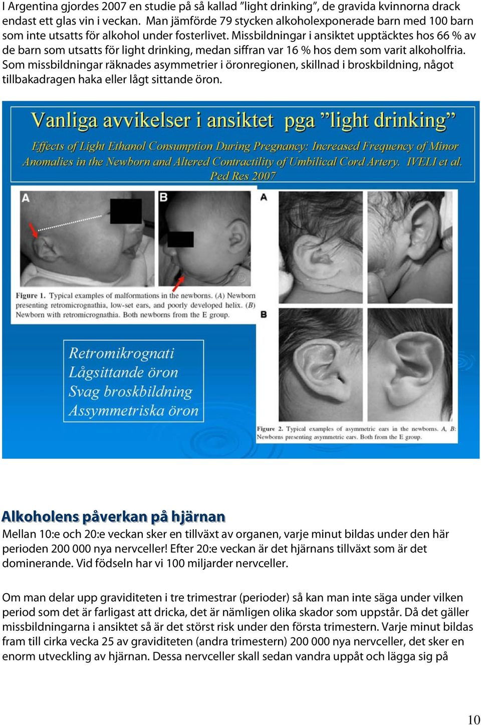 Missbildningar i ansiktet upptäcktes hos 66 % av de barn som utsatts för light drinking, medan siffran var 16 % hos dem som varit alkoholfria.