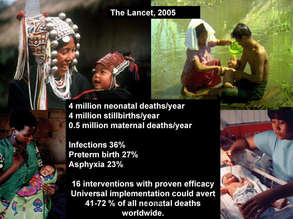 5 million maternal deaths/year Infections 36% Preterm birth 27% Asphyxia