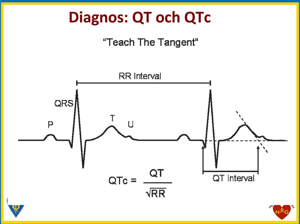 QTc