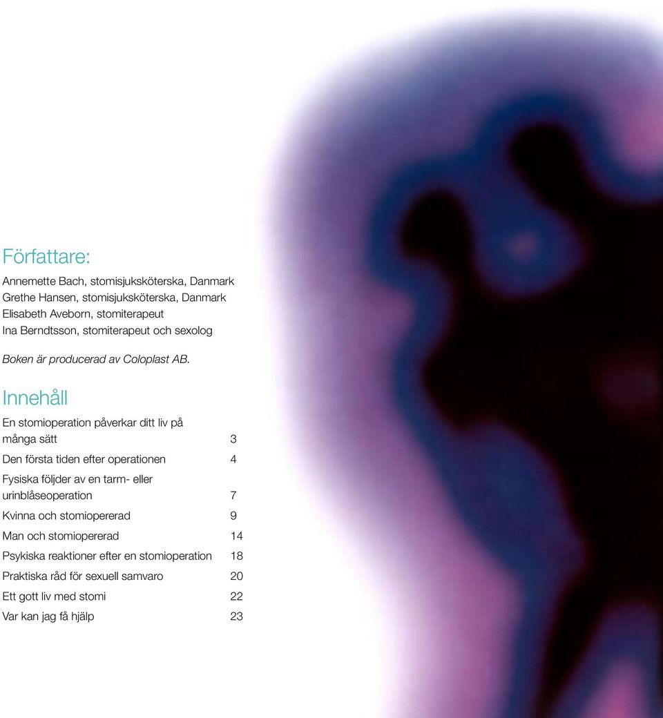 Innehåll En stomioperation påverkar ditt liv på många sätt 3 Den första tiden efter operationen 4 Fysiska följder av en tarm- eller