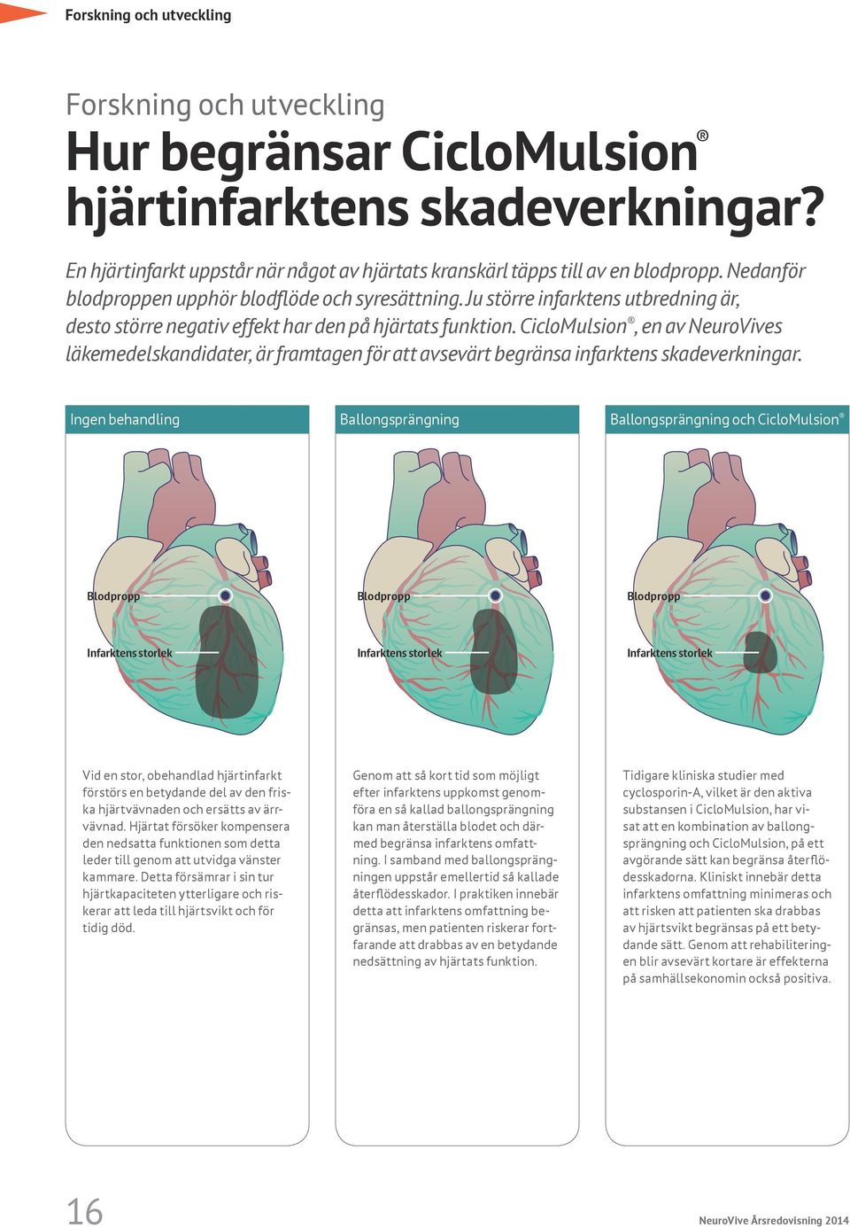 CicloMulsion, en av NeuroVives läkemedelskandidater, är framtagen för att avsevärt begränsa infarktens skadeverkningar.