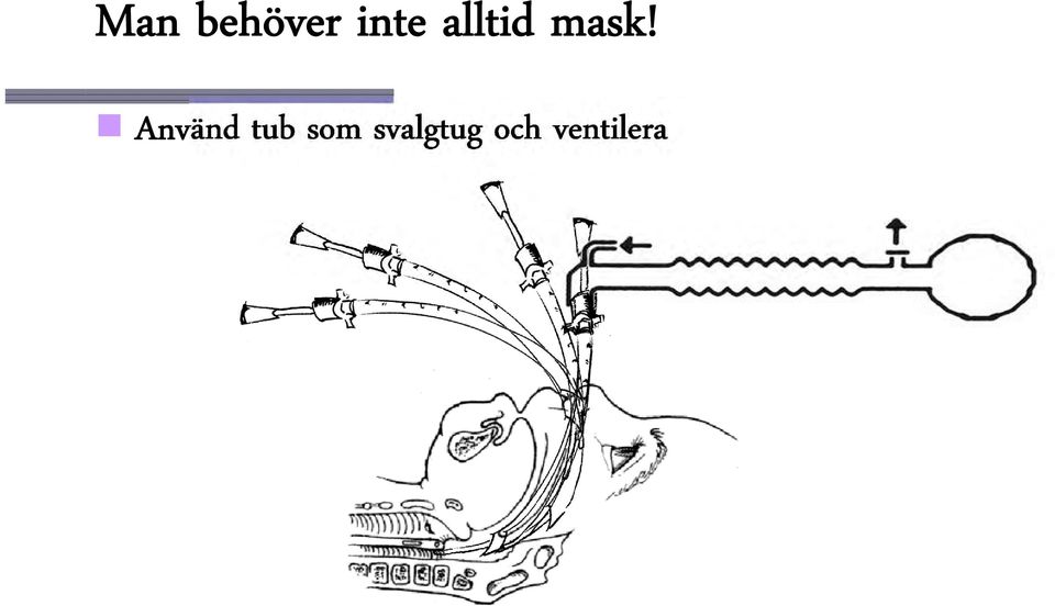 Använd tub som