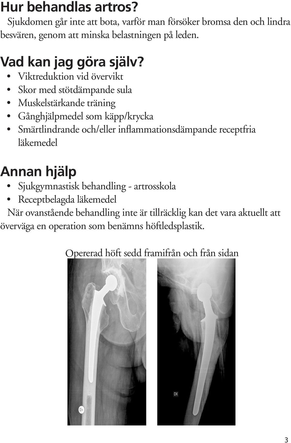 Viktreduktion vid övervikt Skor med stötdämpande sula Muskelstärkande träning Gånghjälpmedel som käpp/krycka Smärtlindrande och/eller