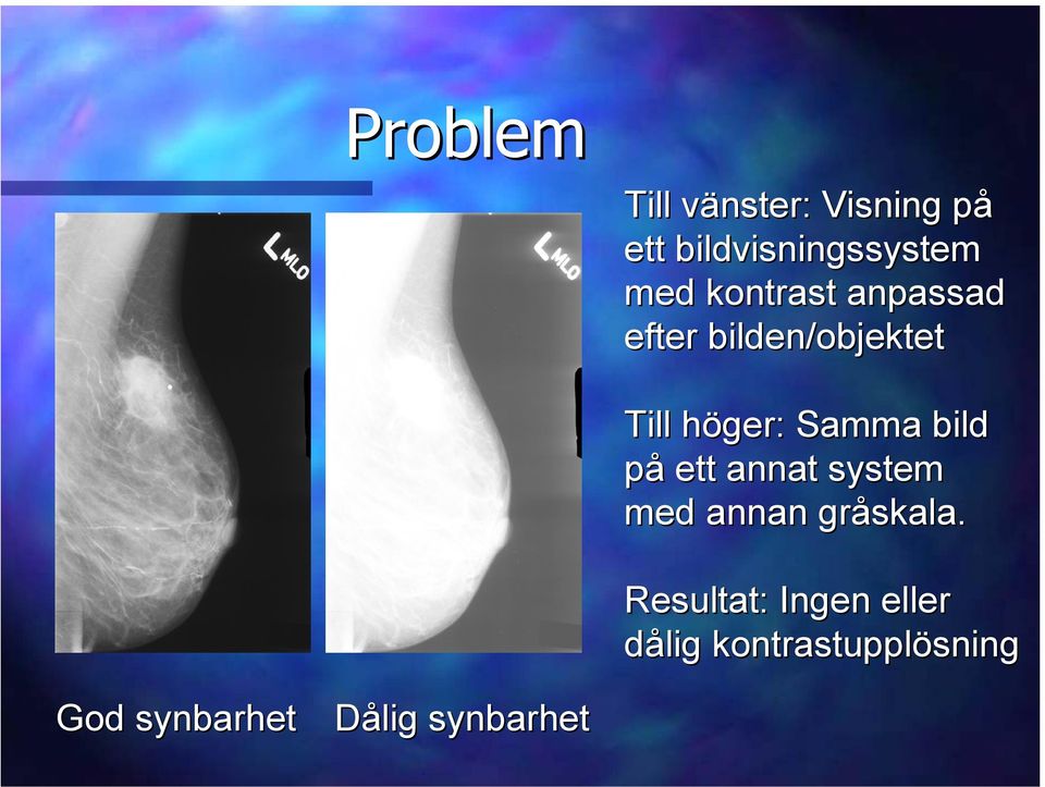 bild på ett annat system med annan gråskala.