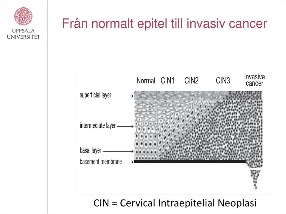 CIN = Cervical